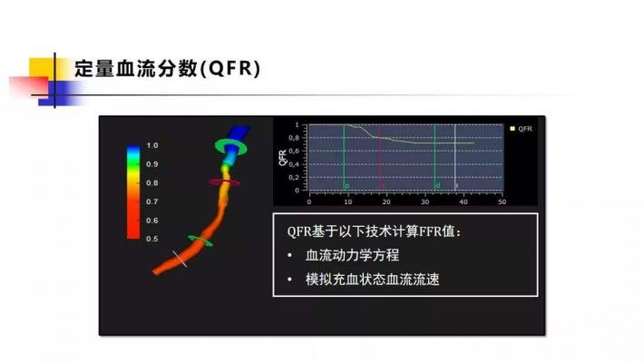 定量血流分數測量軟件AngioPlus Core