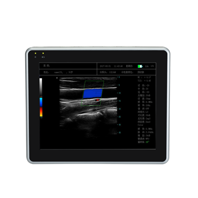 平板式全數字彩色多普勒超聲診斷系統meye1